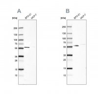 Anti-PDP1 antibody produced in rabbit HPA021152-100UL
