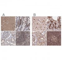 Anti-PDS5A antibody produced in rabbit