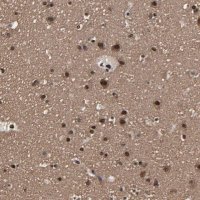 Anti-PDZD4 antibody produced in rabbit