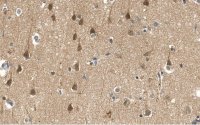 Anti-PEA15 Antibody, clone 2J13 ZooMAb� Rabbit Monoclonal 