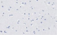 Anti-PEA15 Antibody, clone 2J13 ZooMAb� Rabbit Monoclonal 