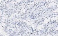 Anti-PER2 Antibody, clone 1G17 ZooMAb� Rabbit Monoclonal 