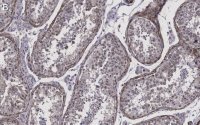 Anti-Pericentrin Antibody, clone 2H11, ZooMAb® Rabbit Monoclonal