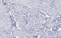 Anti-Peripherin Antibody, clone 1D4, ZooMAb� Rabbit Monoclonal 