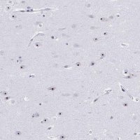 Anti-PES1 antibody produced in rabbit 