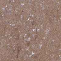 Anti-PEX5L antibody produced in rabbit 