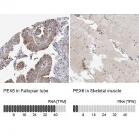 Anti-PEX6 antibody produced in rabbit