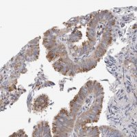 Anti-PEX6 antibody produced in rabbit