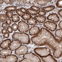 Anti-PFDN2 antibody produced in rabbit 