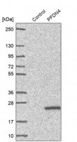 Anti-PFDN4 antibody produced in rabbit HPA024055-100UL