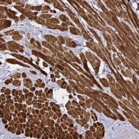 Anti-PGAM2 antibody produced in rabbit 