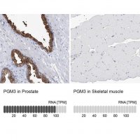 Anti-PGM3 antibody produced in rabbit 