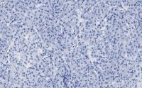 Anti-PGP9.5/UCHL1 Antibody, clone 3C13 ZooMAb� Rabbit Monoclonal 