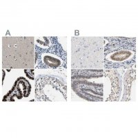 Anti-PGR antibody produced in rabbit 
