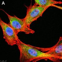 Anti-phospho-IRE-1 (Ser724) Antibody, clone 1M2 ZooMAb� Rabbit Monoclonal 
