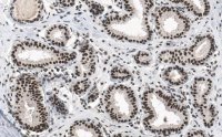 Anti-phospho-p53 (Ser15) Antibody, clone 5L22 ZooMAb� Rabbit Monoclonal 