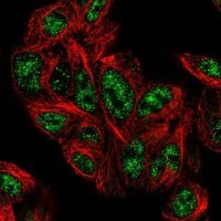 Anti-PHYHD1 antibody produced in rabbit