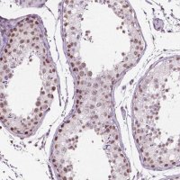 Anti-PIAS2 antibody produced in rabbit 