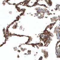 Anti-PIEZO1 antibody produced in rabbit