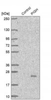Anti-PIGH antibody produced in rabbit HPA031624-100UL
