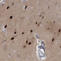 Anti-PINX1 antibody produced in rabbit HPA023139-100UL