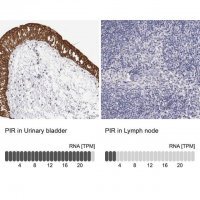 Anti-PIR antibody produced in rabbit 