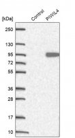 Anti-PIWIL4 antibody produced in rabbit