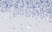 Anti-PKC Antibody, clone 1C13 ZooMAb� Rabbit Monoclonal 