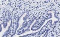 Anti-PKC Antibody, clone 1J13 ZooMAb® Rabbit Monoclonal