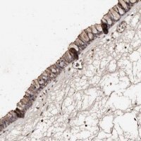Anti-PKDCC antibody produced in rabbit 