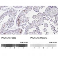 Anti-PKDREJ antibody produced in rabbit 