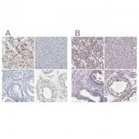 Anti-PKP2 antibody produced in rabbit