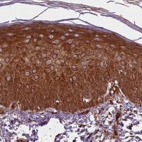 Anti-PKP3 antibody produced in rabbit