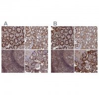 Anti-PLA2G15 antibody produced in rabbit 