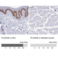 Anti-PLA2G4E antibody produced in rabbit 