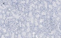 Anti-PLA2R1 Antibody, clone 1D5, ZooMAb� Rabbit Monoclonal 