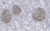 Anti-PLA2R1 Antibody, clone 1D5, ZooMAb� Rabbit Monoclonal 