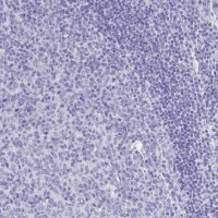 Anti-PLAC1 antibody produced in rabbit 