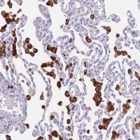 Anti-PLBD1 antibody produced in rabbit 