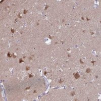 Anti-PLCB1 antibody produced in rabbit 