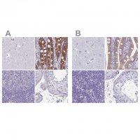 Anti-PLCB3 antibody produced in rabbit