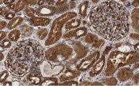 Anti-PLD2 Antibody, clone 6F13 ZooMAb� Rabbit Monoclonal 