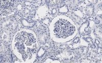 Anti-PLD2 Antibody, clone 6F13 ZooMAb� Rabbit Monoclonal 