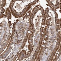 Anti-PLEKHA7 antibody produced in rabbit