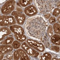 Anti-PLEKHM1 antibody produced in rabbit 
