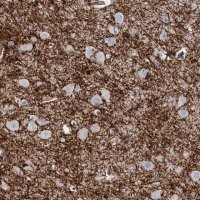 Anti-PLLP antibody produced in rabbit