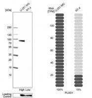 Anti-PLOD1 antibody produced in rabbit HPA049137-100UL