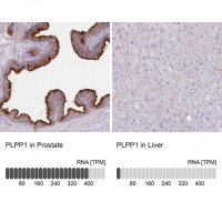 Anti-PLPP1 antibody produced in rabbit 