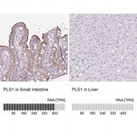 Anti-PLS1 antibody produced in rabbit 