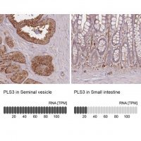 Anti-PLS3 antibody produced in rabbit 